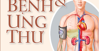 Huyết Áp Giả Và Bệnh Ung Thư